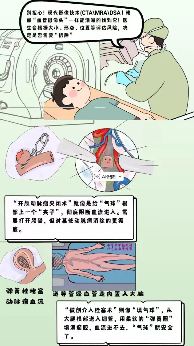 图文组一等奖《大脑里的“定时炸弹”--揭秘颅内动脉瘤》